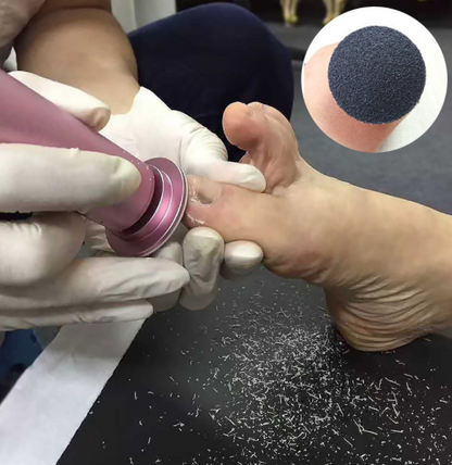 Herramienta eléctrica para pedicura, cuidado de pies, limas